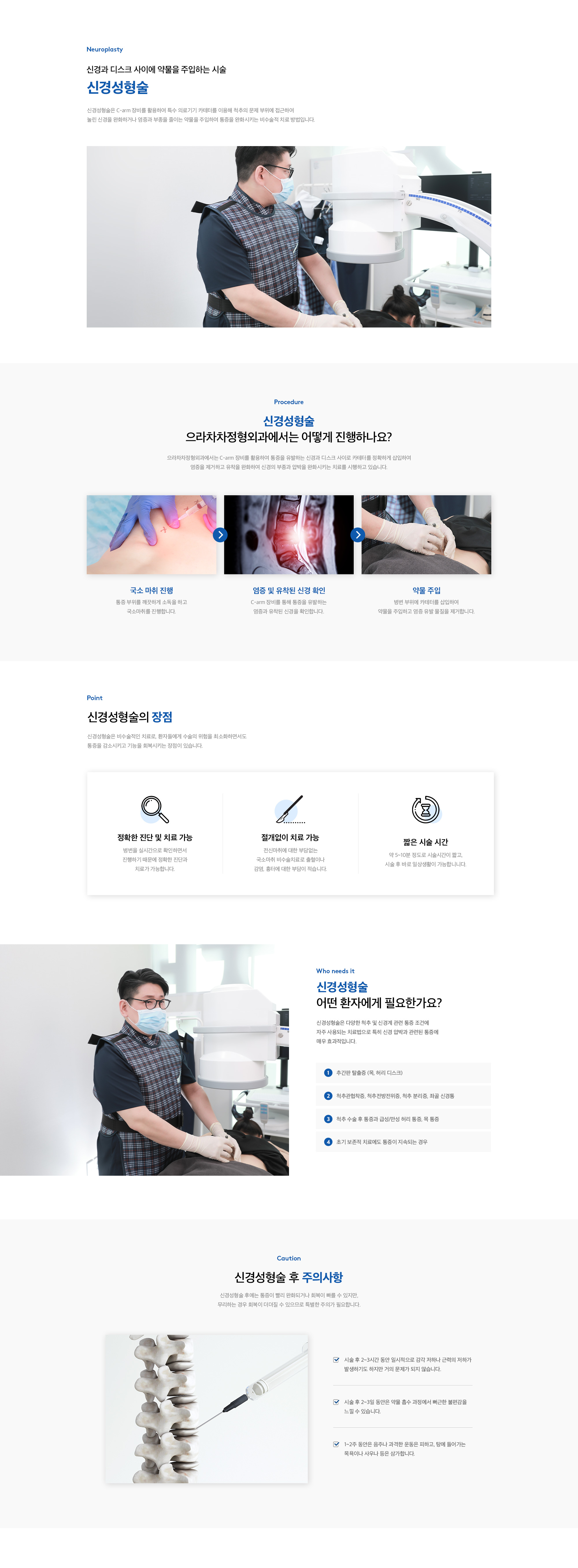 신경성형술